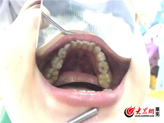 莱芜牙博士口腔联系电话,莱芜牙博士整牙要多少钱