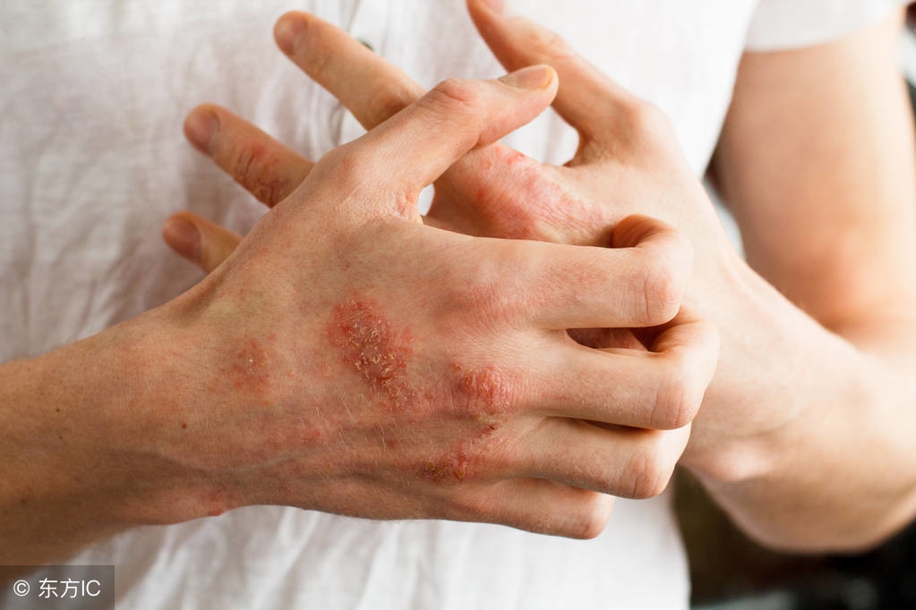 你了解慢性病吗,25个疾病治愈小妙招