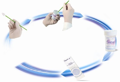 cin一级宫颈癌平时应该注意什么,恩哥聊健康宫颈癌有哪些症状