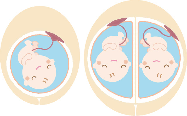 产后胎盘粘连有可能胎盘植入吗,产后胎盘粘连吃药能排出来吗