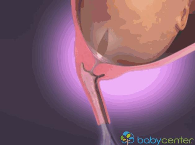 3d模拟受孕过程,3d模拟孕妇变化