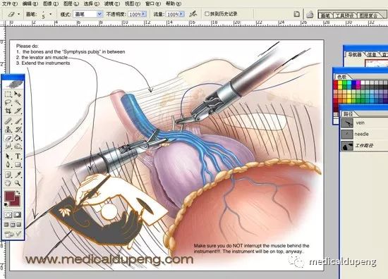 医学插画插图,医学插画sci