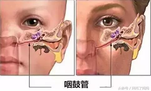 清鼻涕浓稠,清鼻涕小妙招婴儿