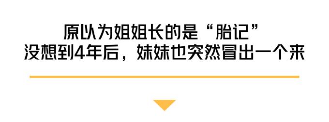 娃身上有好几处白斑,娃脸上有白斑是怎么回事