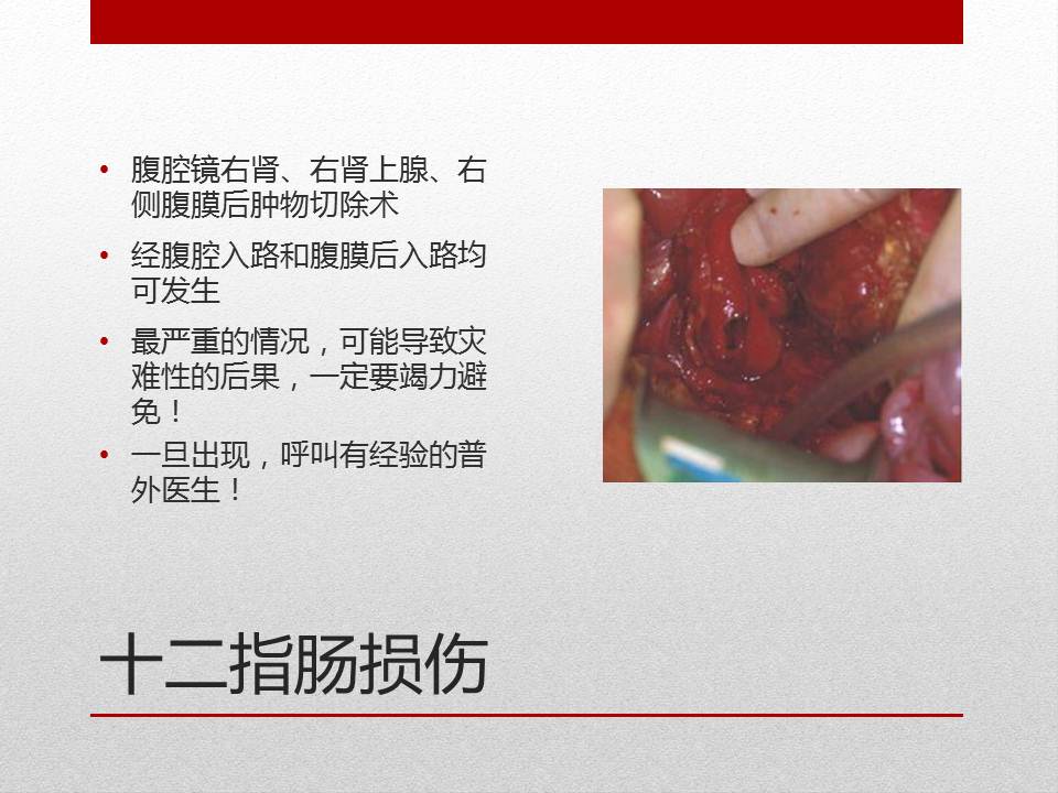 泌尿外科腹腔镜手术适应症,泌尿外科腹腔镜并发症