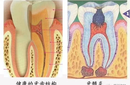 牙疼不是病痛起来要人命图片,牙疼不是病疼得要人命
