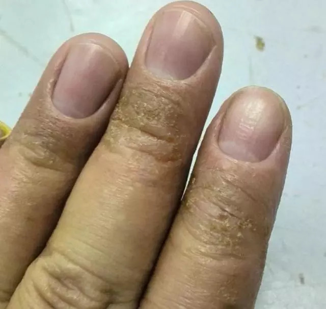 钓鱼遇到最痛苦的事情,钓鱼容易受伤吗