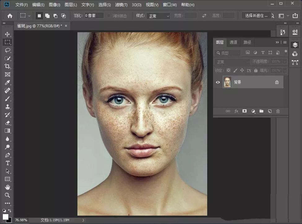 祛除脸部雀斑最有效的方法,有什么日常方法可以去除脸上雀斑