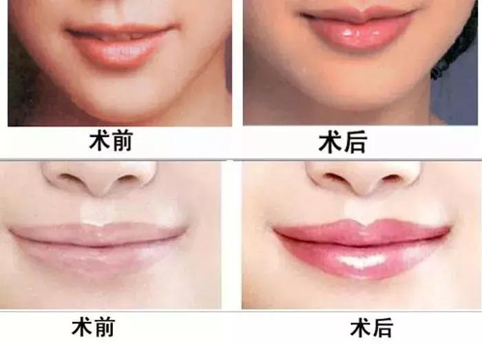 半永久眉毛为什么做不到一模一样,半永久眉毛即刻成效果