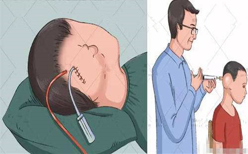 代涛博士讲座完整版,代涛厦门大学博士