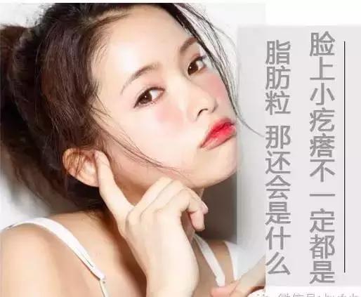 儿童脸上长一粒粒小疙瘩像脂肪粒,宝宝脸上起的类似脂肪粒的疙瘩