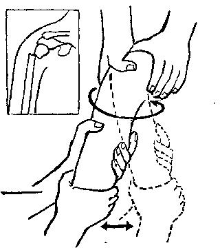 中医骨折治疗原则,中医骨伤整复术