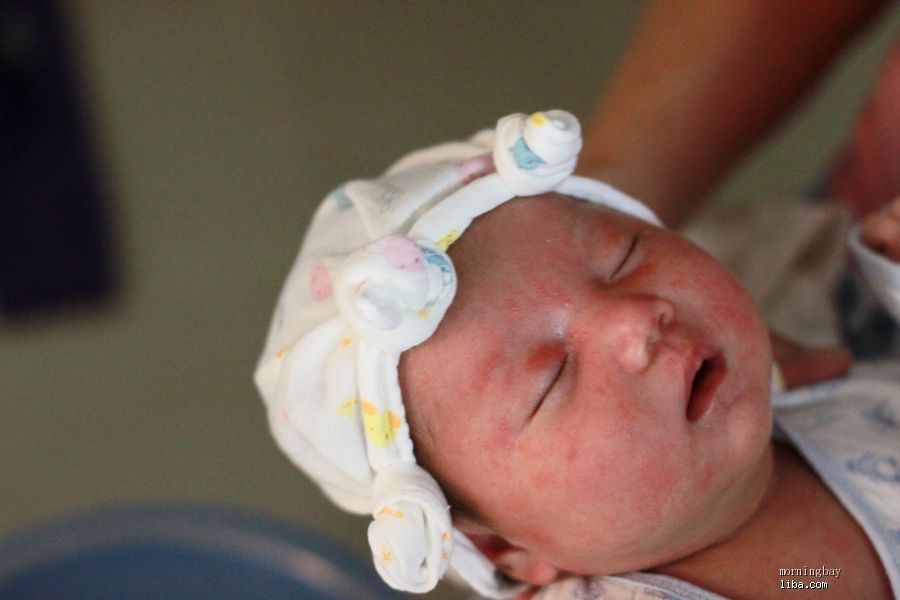 新生儿脸上长红色小疹子,新生儿白色颗粒疹子