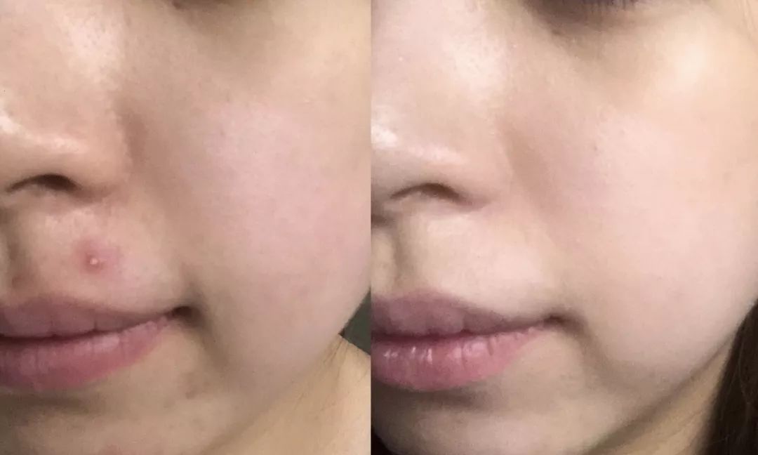 充电10分钟，水嫩一整天！这盒澳洲“断货王”面膜也太好用了吧！