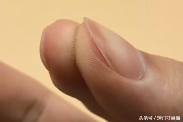 手指被502胶粘了该怎么快速解开,手指和手指被502胶水粘住了怎么办