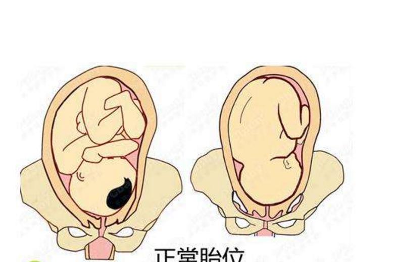 顺产遭罪吗,剖腹产6小时以后勤翻身的好处