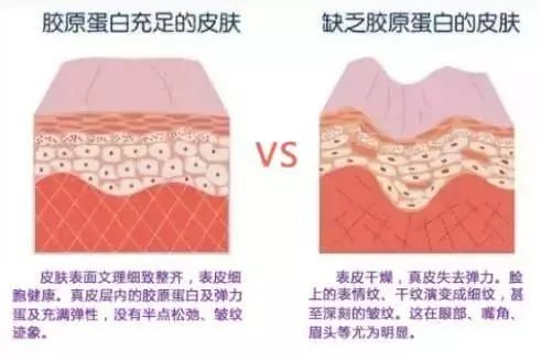 微商胶原蛋白是真的吗,微商胶原蛋白骗局揭秘