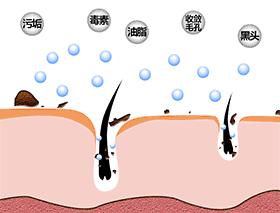 去黑头收缩毛孔的正确方法实测,严重黑头毛孔粗大怎么去除最有效