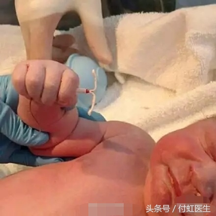 带环会怀孕的宝宝能要不,带环怀孕孩子还能要吗