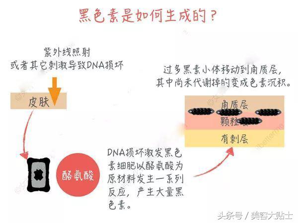 紫外线淡化斑小妙招,脸上有紫外线色斑怎么办