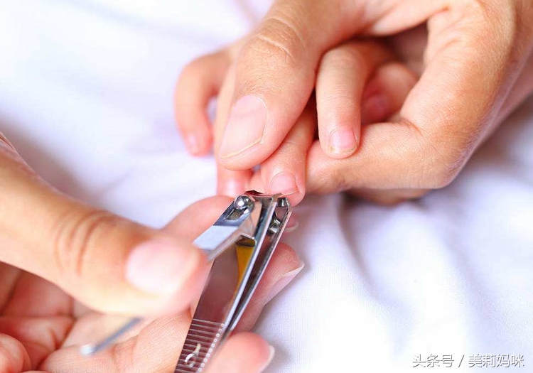 孩子手指起倒刺治疗小妙招,宝宝手指长倒刺怎么办