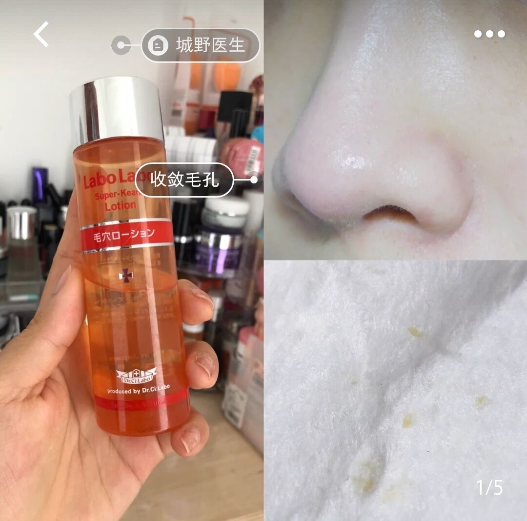 小红书被人避雷怎么办,小红书被黑号的表现