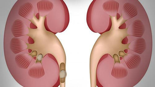 血尿的原因及诊疗,什么是血尿引起血尿的原因是什么