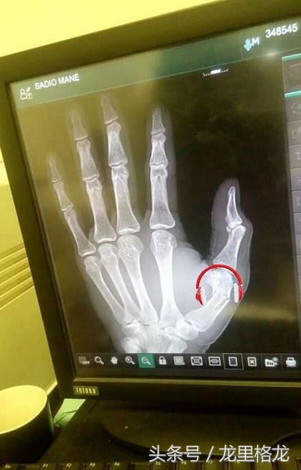 20年利物浦对水晶宫,20年利物浦对巴萨