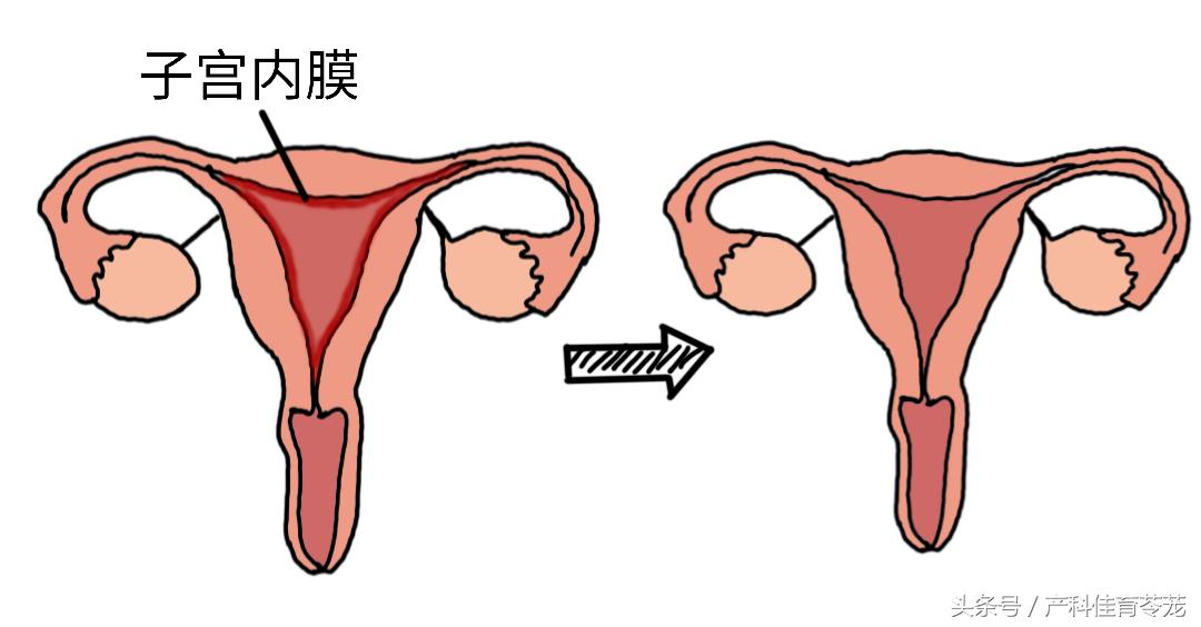 人流对身体损伤最小的方式,人流导致创伤怎么修复
