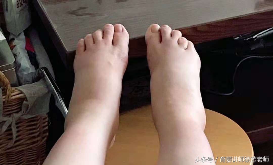 孕妇孕后期注意事项,孕期腹部护理正确方法