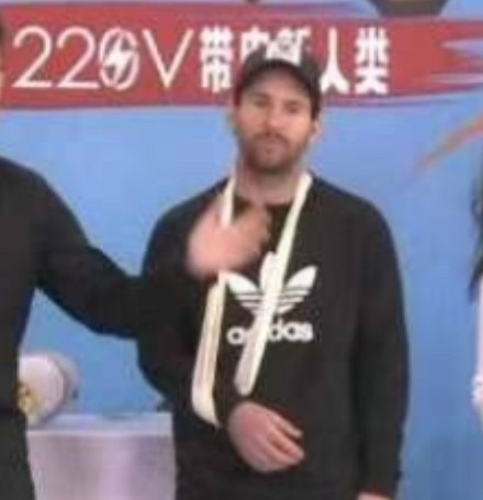 梅西打乒乓球手骨折,梅西中国行2018斗鱼