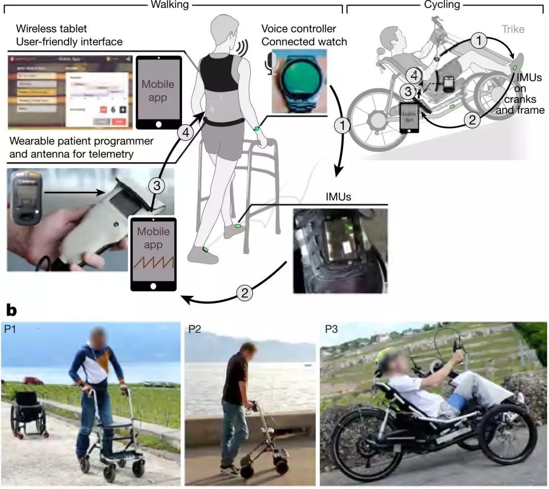 切除阑尾与pd关系,切阑尾怀疑肿瘤