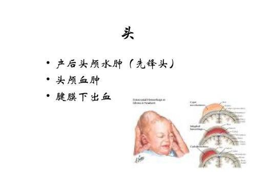 宝宝一出生头上就长这种瘤，如何识别良性OR恶性？新妈妈快来看看