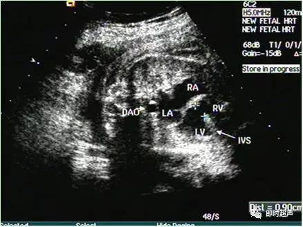 产科常规彩色超声报告单介绍,常见妇科疾病超声报告