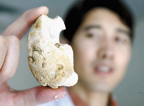 肾结石尿尿疼痛怎么办,肾结石如果尿尿恢复正常还是很疼