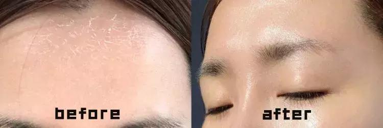 烟酰胺玻尿酸水光焕颜片美白效果,烟酰胺玻尿酸精华液美白淡斑霜