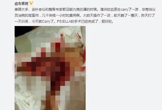 lol史上最离谱的一件事,lol最悲惨的一场