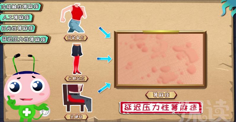 引起荨麻疹最常见感染的原因,荨麻疹皮疹一般的处理措施