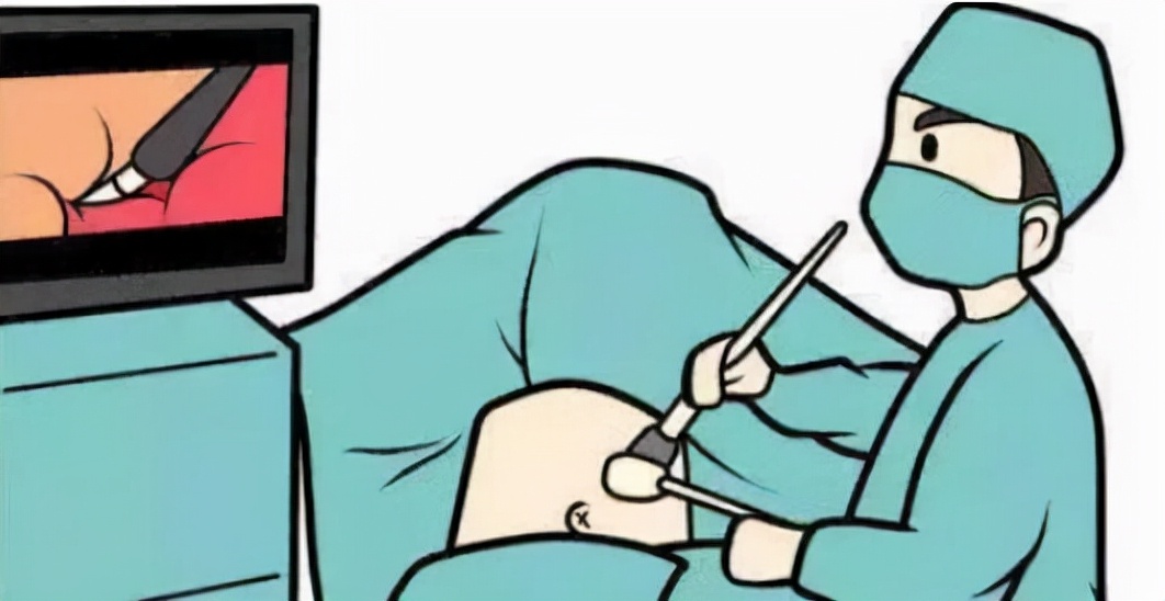 “汗友”治疗手汗症的心路历程：改造“水手”，重焕干爽