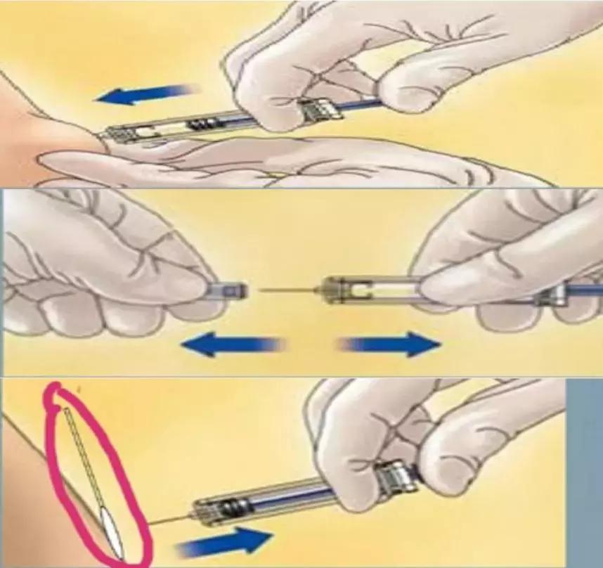 让护士爱恨交加的低分子肝素