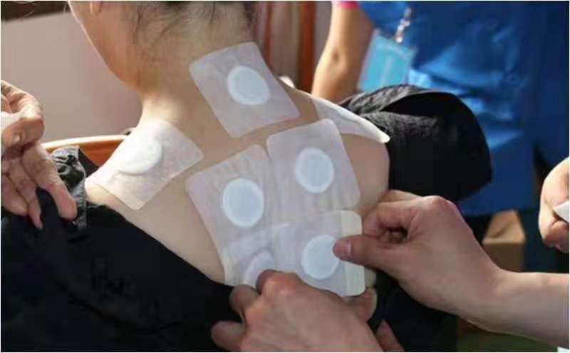 内蒙古自治区中医医院三九贴,中医院三伏贴订购