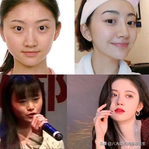 光子嫩肤会让皮肤变薄吗,长期光子嫩肤皮肤会变薄吗