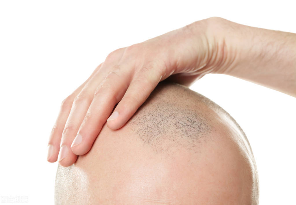 00后戴起假发片整个头顶已“寸草不生”，90后开始深受肩颈腰腿痛困扰脖子一仰10根脚趾像电击一样痛