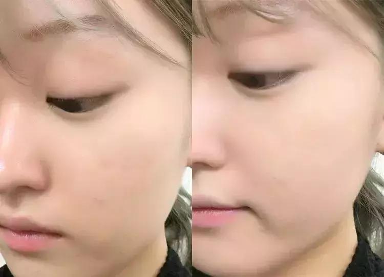 全世界最好用的大牌粉底,全国最好用的气垫