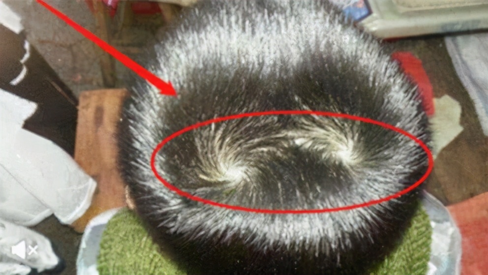 孩子的头旋长偏了是怎么回事,孩子的头旋是歪的