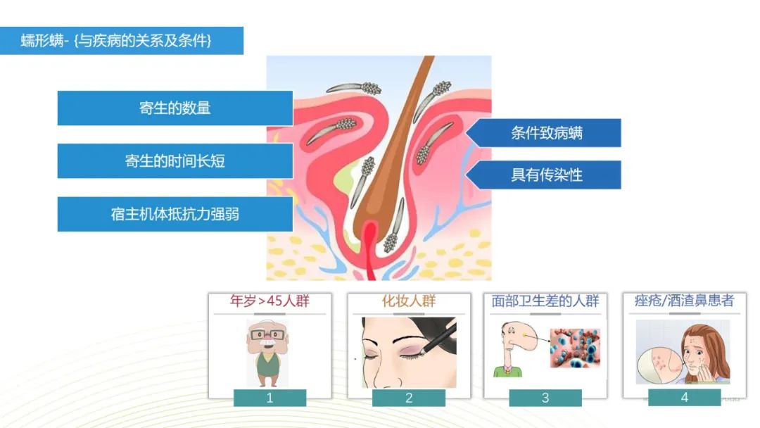 眼睛总是痒？总感觉眼睛里有东西？结膜炎角膜炎反反复复？可能是你的眼睛里有螨虫