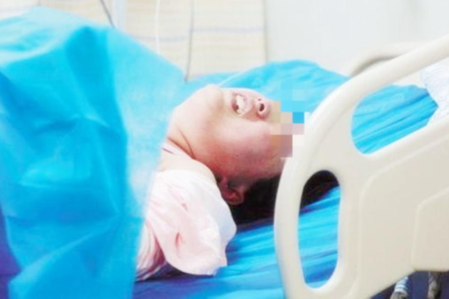 你以为生孩子最痛的是分娩吗,你以为的剖腹产实际的剖腹产