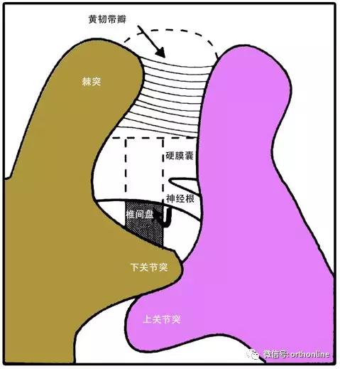 脊柱手术后如何预防脑脊液漏,怎么减少术后瘢痕形成