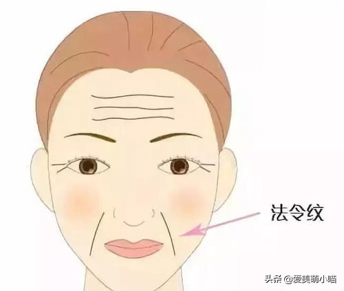 如何拯救暴瘦后的法令纹,不花钱怎么拯救法令纹