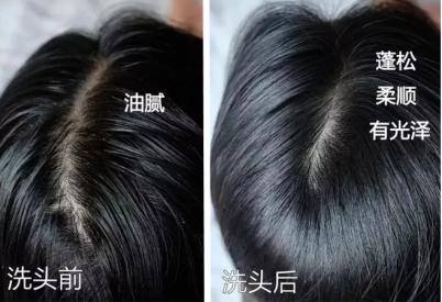 油头救星澳洲茶树洗发水,茶树精油酸性顺滑洗发水